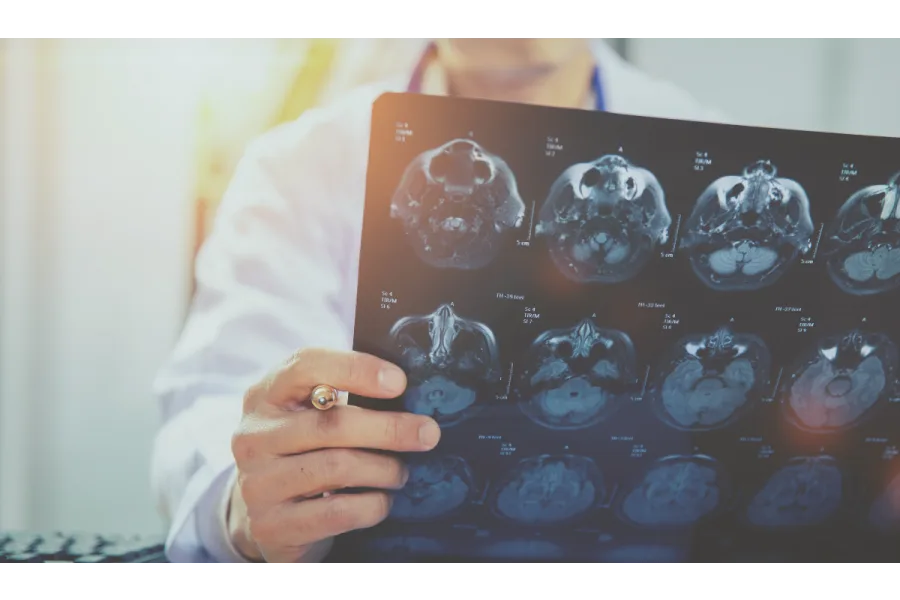 What is PTSD and How Can Medical Cannabis Help?