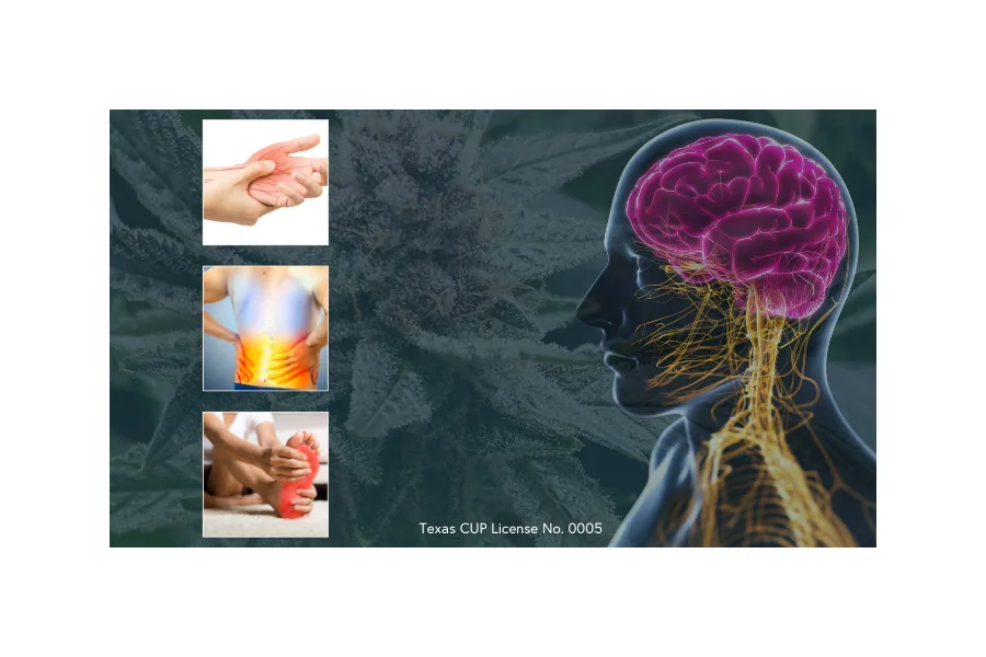 Relieving Neuropathy with Medical Cannabis